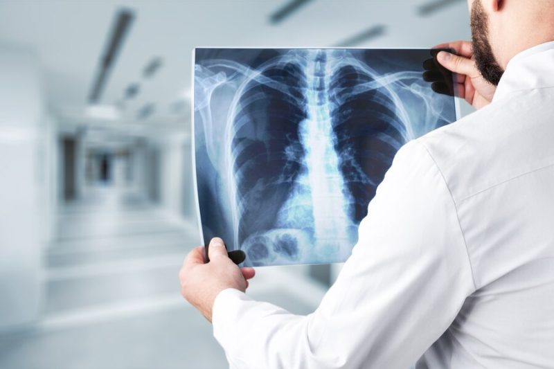 xray